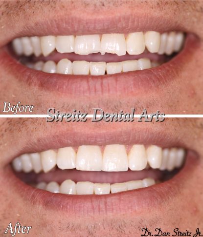 Cosmetic Dentistry