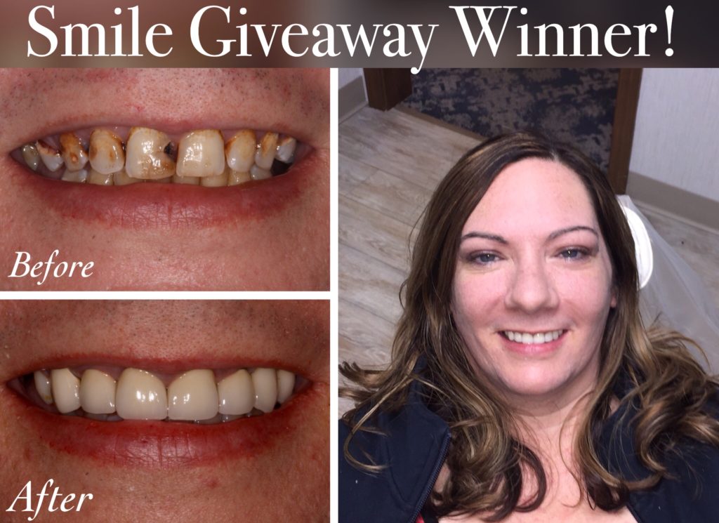 Smile Makeover Giveaway Streitz Dental Arts